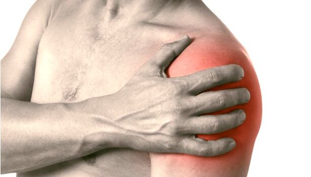 Shoulder swelling, redness and enlargement - symptoms of grade 2-3 shoulder osteoarthritis