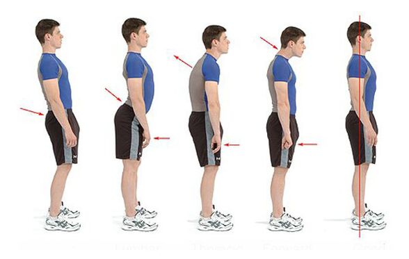 Preventing bones and joints