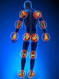 The localization of joints is affected by arthritis