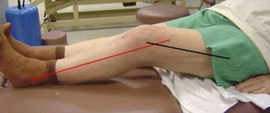 Progress of knee joint