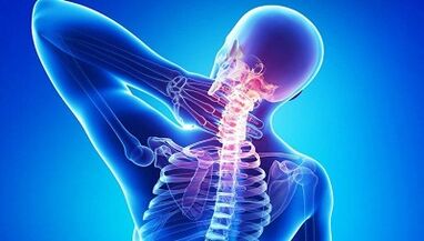 How does osteoarthritis manifest