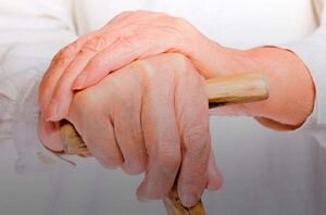 finger joint pain due to rheumatoid arthritis