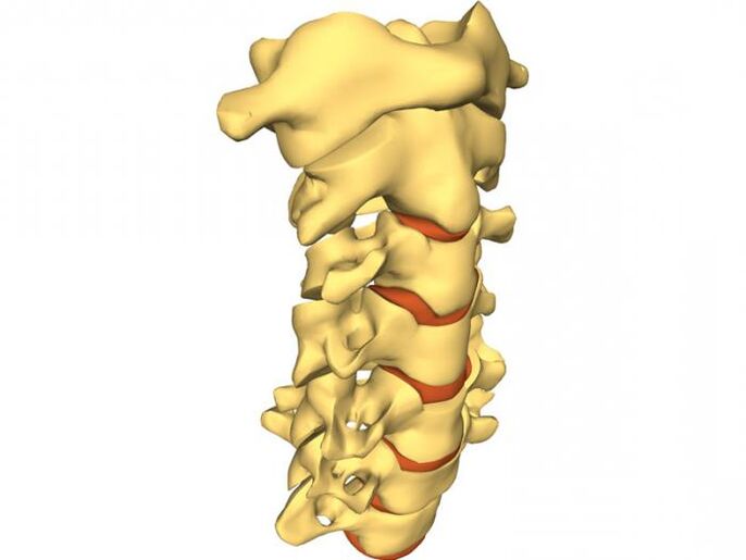 The spine is prone to bone necrosis