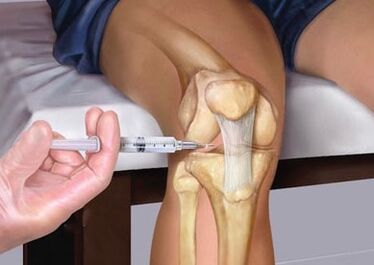 Injection