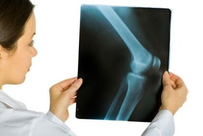 Knee joint treatment