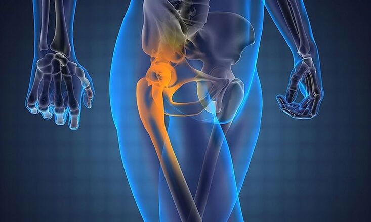 Hip joint pain