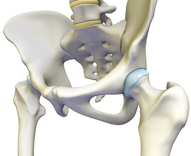 Osteoarthritis causes sharp pain in the hip joint