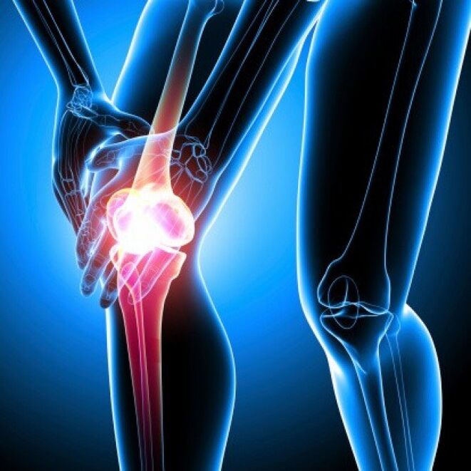 Severe rheumatoid arthritis can cause hip pain