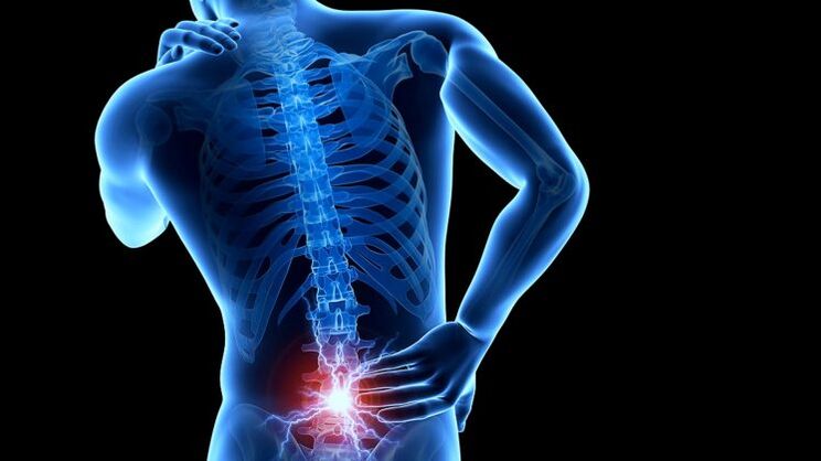 back pain with lumbar spondylosis
